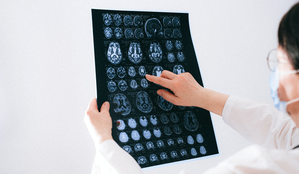 Understanding Traumatic Brain Injury